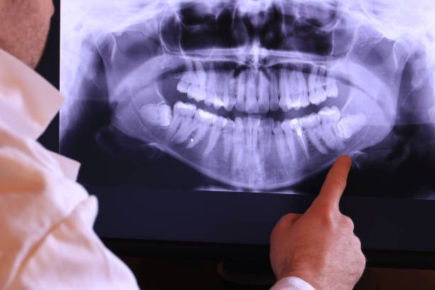 Best Emergency Dental Care for Sports Injuries in Fairfield, TX